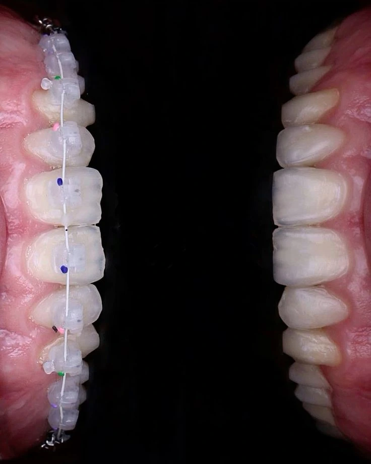 Orthodontics Image 2