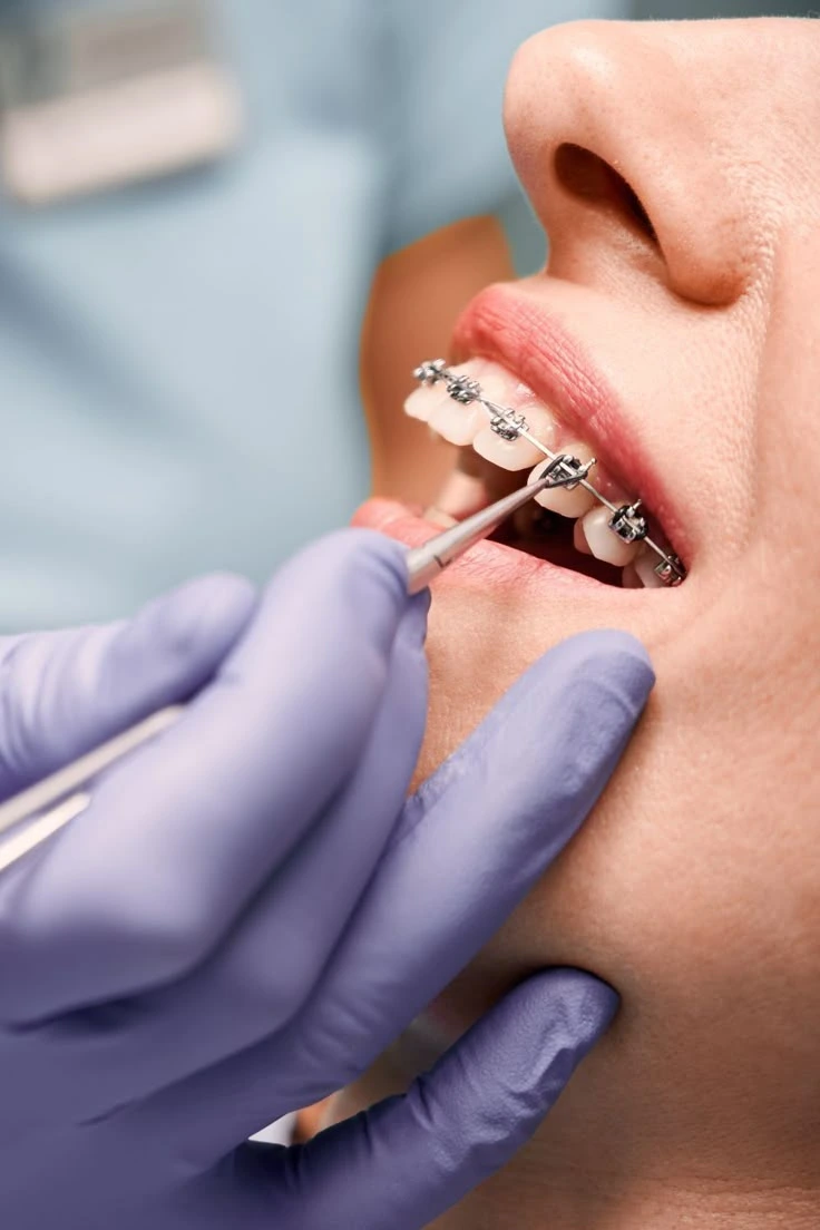 Orthodontics Image 1